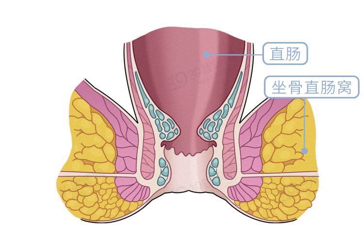 女生脱肛图片