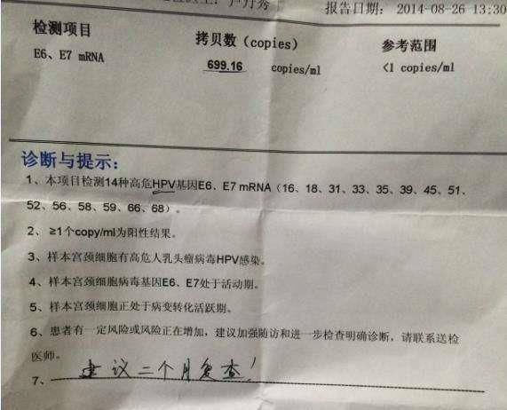 男的单手解内衣证明_美女单手解内衣内裤(2)