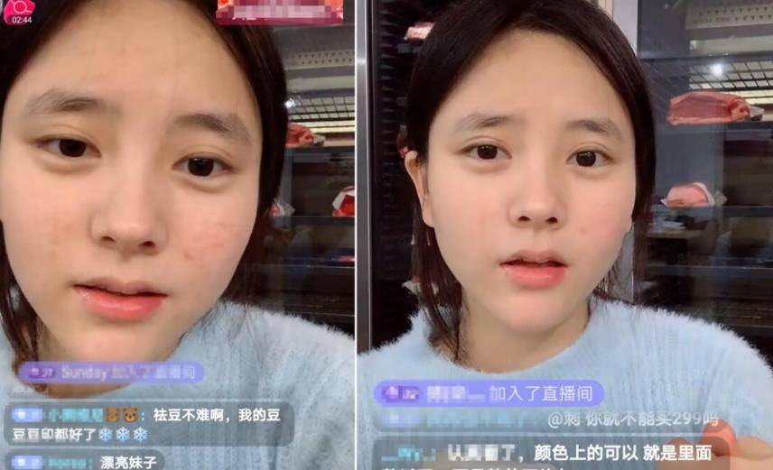 原创小霸宠大方承认整容,自嘲自己"改装美",脸部全动打10支瘦脸针