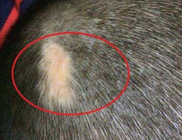 原创剖腹产宝宝头部被划伤,医生说很快就好,五年后父母找上医院