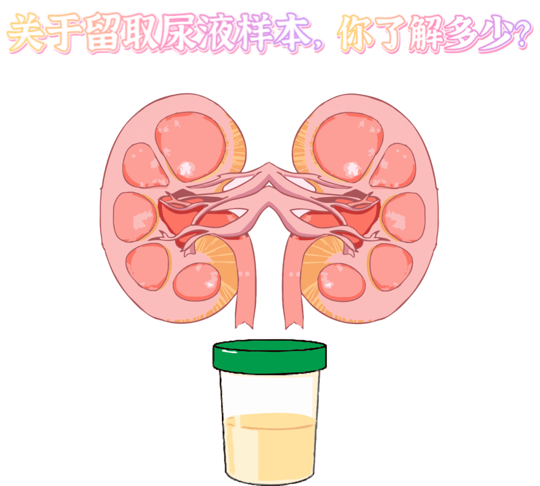 做尿检不得不说的注意事项