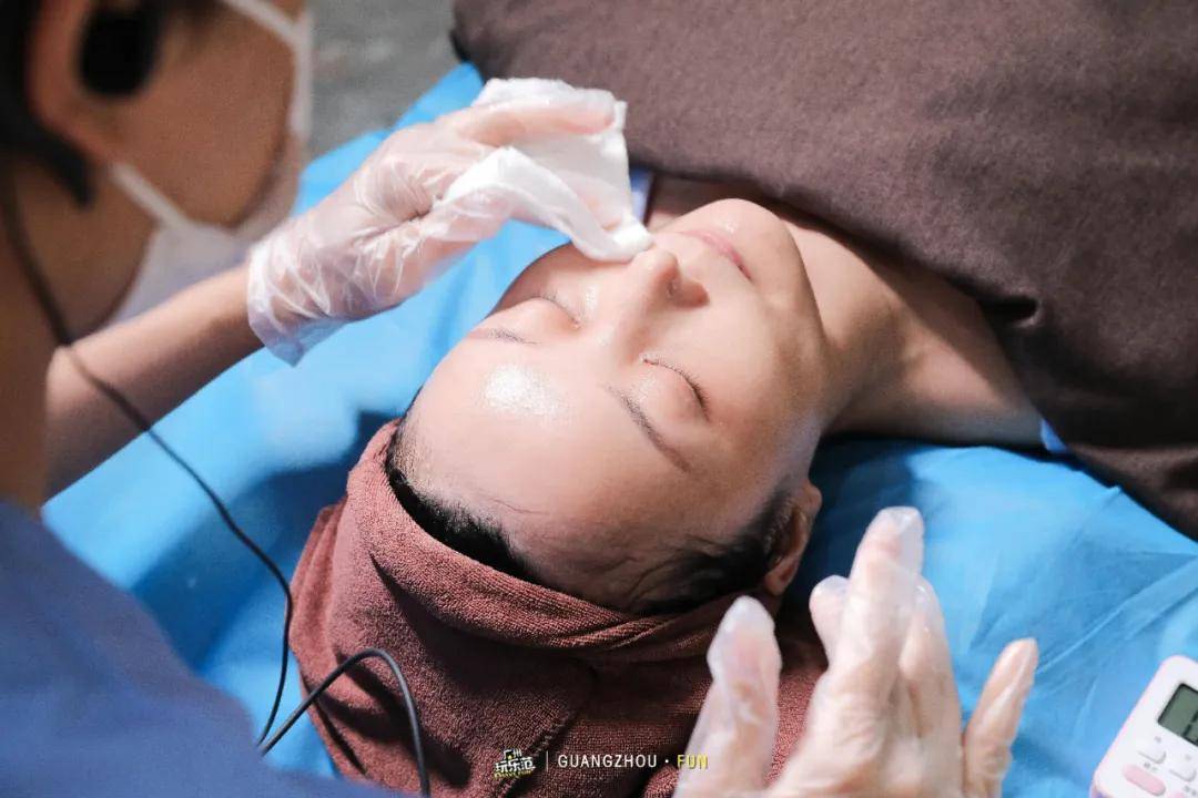 真人探店199元的m22光子果酸我简直像开了10级磨皮