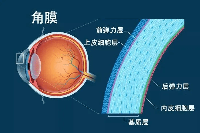 先弄清楚这10个问题!_角膜