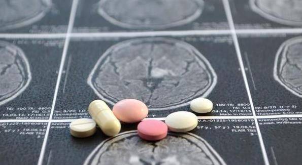 什么原因会引起脑部出血 8cc2a6975a0c48bd91bc111f269b5524.jpeg