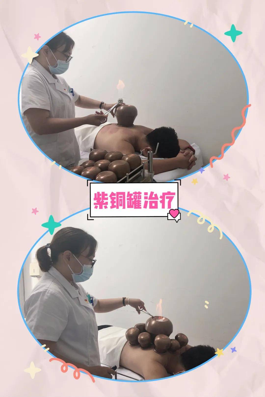 功能|针灸推拿康复科“冬病夏治”最佳搭档——三伏贴、火针、紫铜火罐中医特色组合