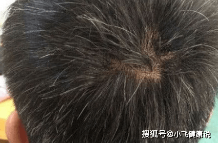 5539d1c231d14a3bae2b6068ea769d9b.png
