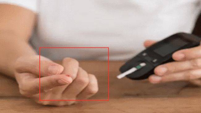 小伙|喝饮料居然能喝进ICU？270斤小伙，连灌8瓶饮料被送进ICU