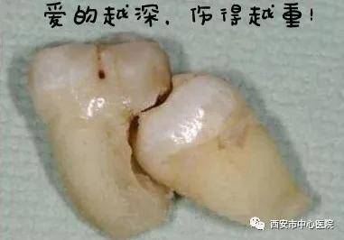 影响|有一种爱叫做放手 有一些牙你想留也留不住