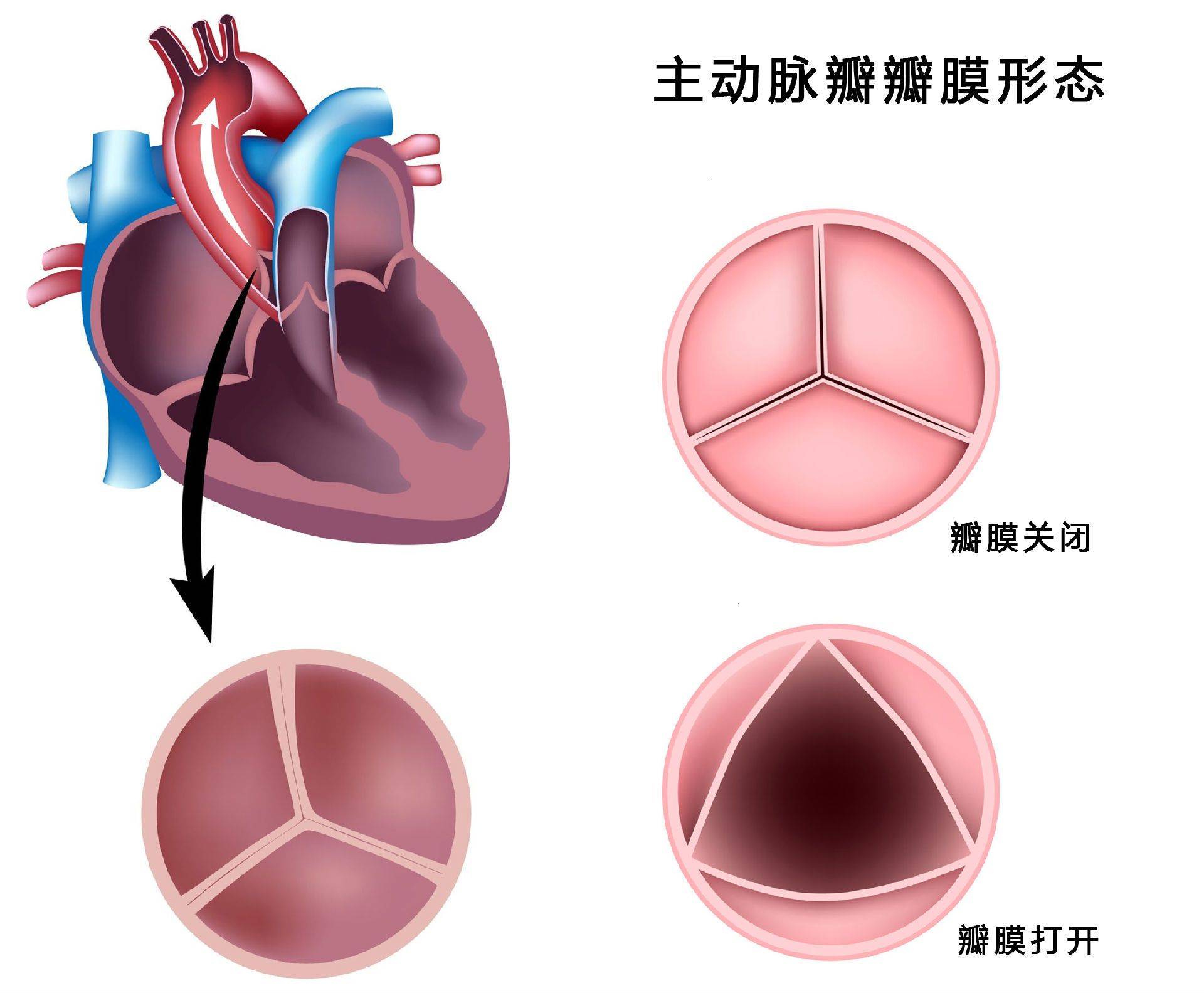 心力衰竭患者心臟不能正常泵血,故而無法滿足身體需求.