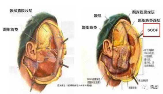 因为|南韩唯一的纯天然美女，怎么40岁就变样了…