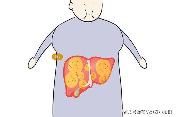 传导|注意,检查出肝脏有低回声,不能盲目判断为肝癌,告诉你其他可能