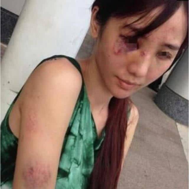 因为|她接下孙俪剧本从而爆红，却在月子期间被家暴，28岁就已去世