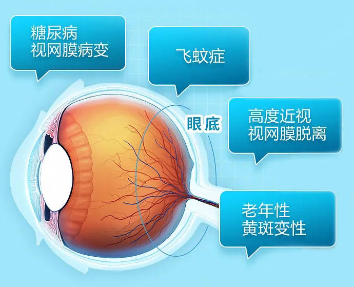 眼底病严重可致盲医生呼吁科学守护眼底健康 患者 眼底病严重可致盲医生呼吁科学守护眼底健康 患者
