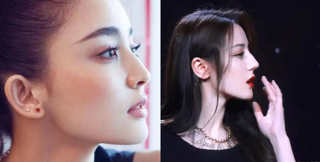 问题|给中年李嘉欣换上刘亦菲同款肉鼻头，会变什么样？