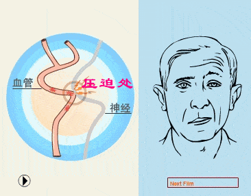 压迫|“左眼跳财右眼跳灾”到底有科学依据吗？专家为你揭秘背后真相