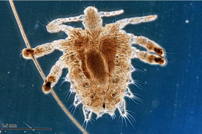 就是寄生在私處毛髮上的蝨子,肉眼形同小米粒,呈灰黃色,頭上有尖銳的