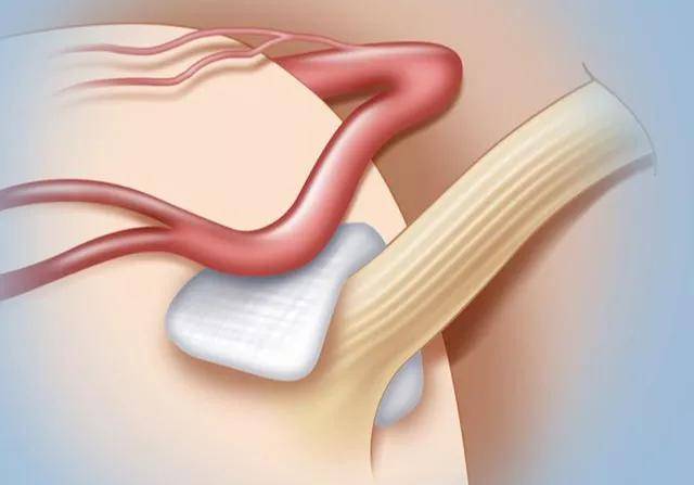 压迫|“左眼跳财右眼跳灾”到底有科学依据吗？专家为你揭秘背后真相
