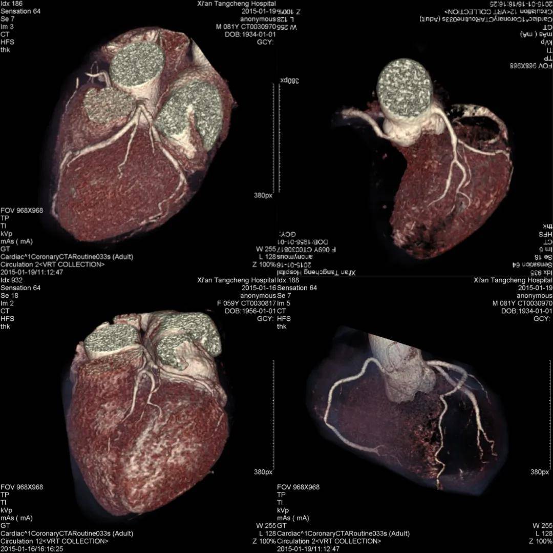 成像|【科室推荐】西安工会医院影像科