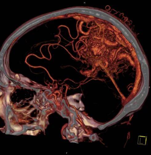 成像|【科室推荐】西安工会医院影像科