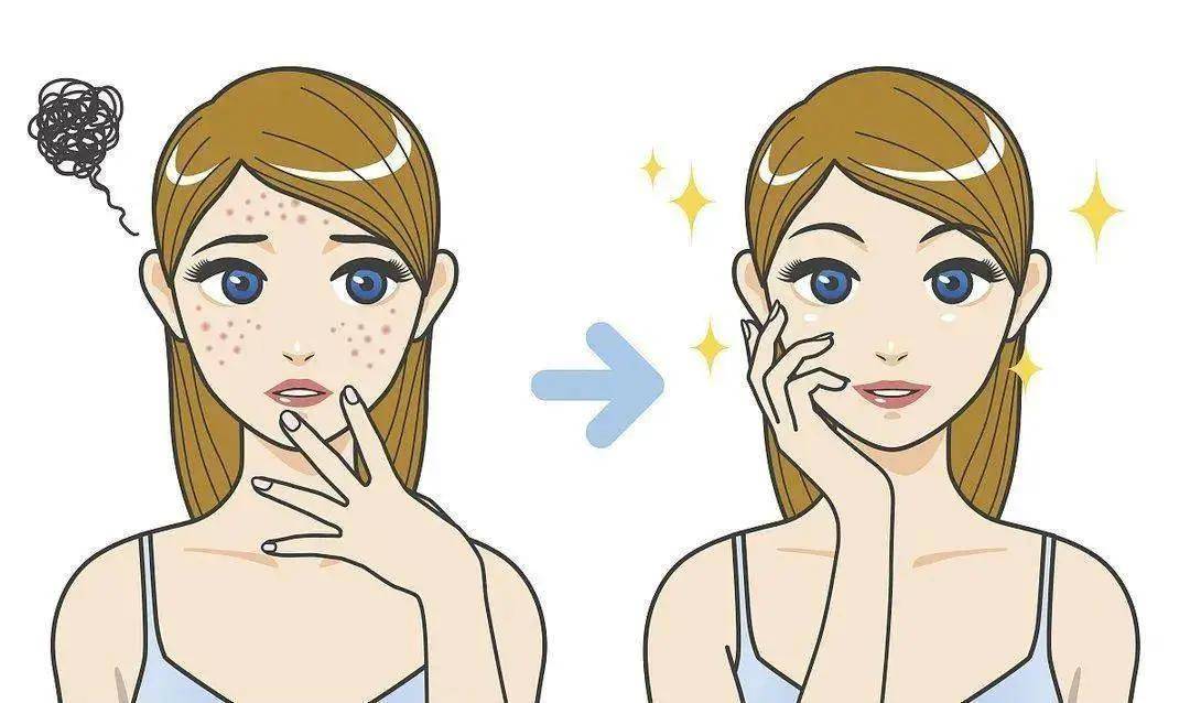 皮肤|爱兰诗 | 痘印色斑衰老接踵而至？一招轻松摆脱黄脸困扰！