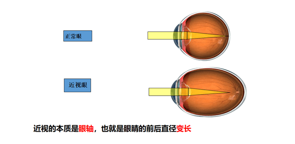 江北区打好组合拳全区幼儿园中小学近视防控负责人参加培训