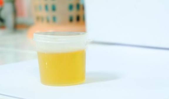 影响|尿中有泡沫,还久久不散?有3个表现,可能得检查一下肾脏