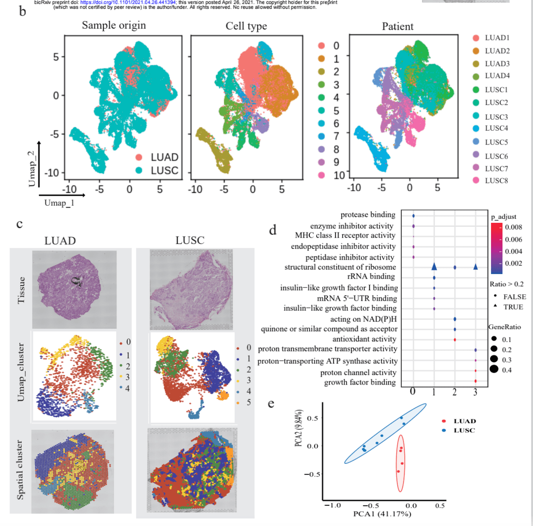 利用10xvisium空间转录组技术揭示非小细胞肺癌的空间轨迹