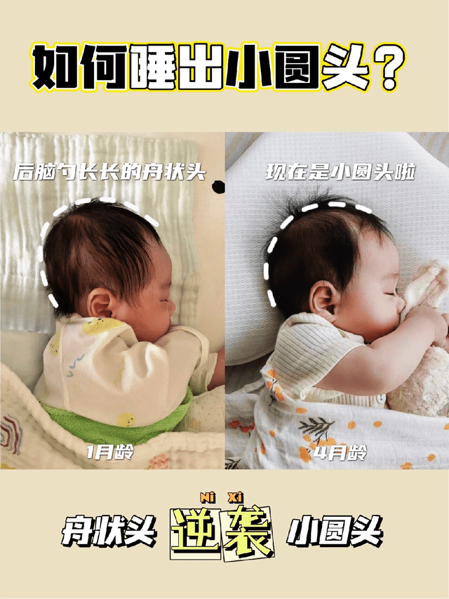 状头|如何成功睡出小圆头？舟状头的逆袭之路！