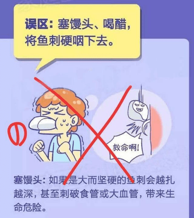 张蓉|骨鲠在喉？别再用“土方法”了！消化内镜最有用