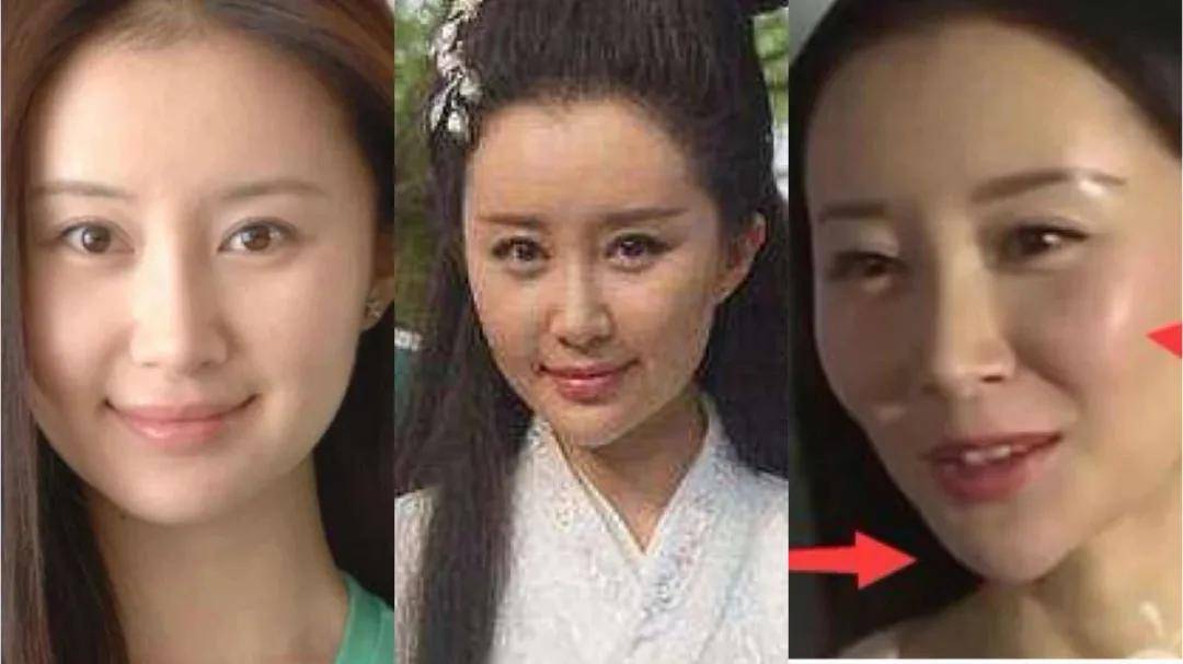 什么|越努力越没眼看，为什么南韩女明星个个精致又肿胀？