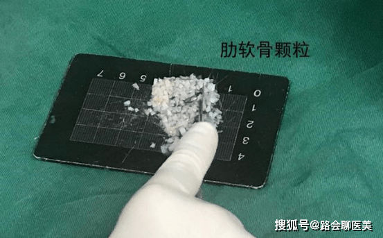 人体|垫鼻基底不想用假体，可以选择肋软骨颗粒吗？