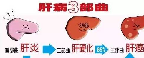 肝脏|肝病不能早期发现?身体出现“2红1黄”,警惕疾病中晚期