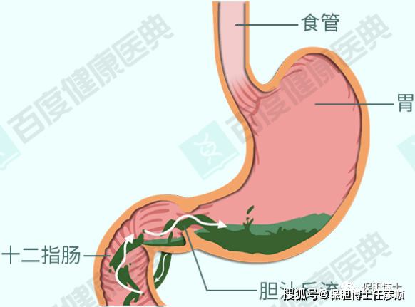 胆囊和胃的连接图图片