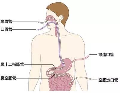 短肽相比氨基酸 蛋白质的5大核心优势 食纳佳立雅易服 人体