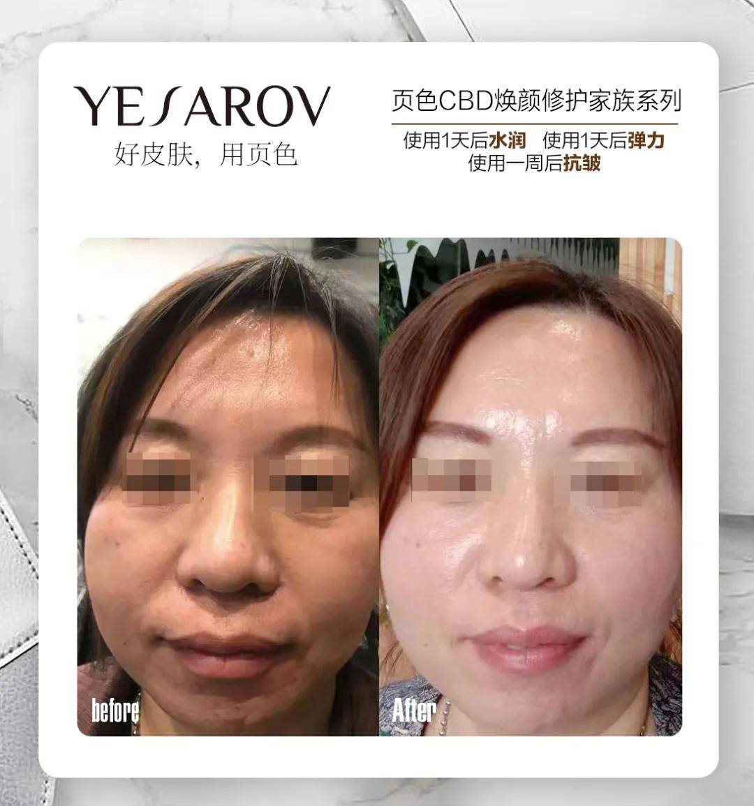 颜修|嘘，有个不成‘纹’的秘密告诉你！