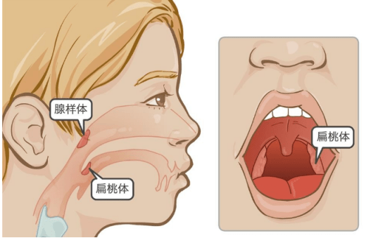 切除儿童的扁桃体和腺样体会增加患 28 种疾病的风险