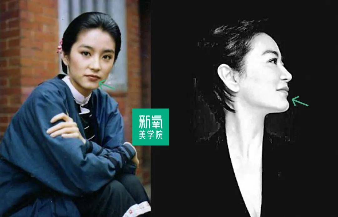 下巴|关晓彤的嘟囔下巴照这个古典路子走能封神？