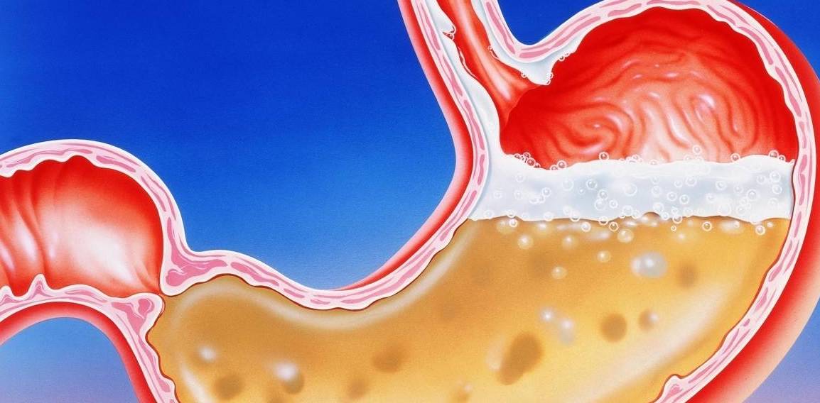 肝脏|三天两头喝酒，对肝伤害大！若有4个阶段，也许是肝挺不住了