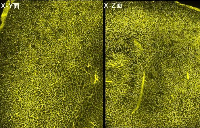 由此可见,采用平铺光片显微镜在微米级空间分辨率下对3d组织进行成像