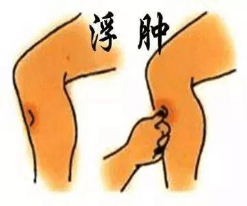 小孩|孩子身体浮肿，尿中有泡，元凶竟然是它？