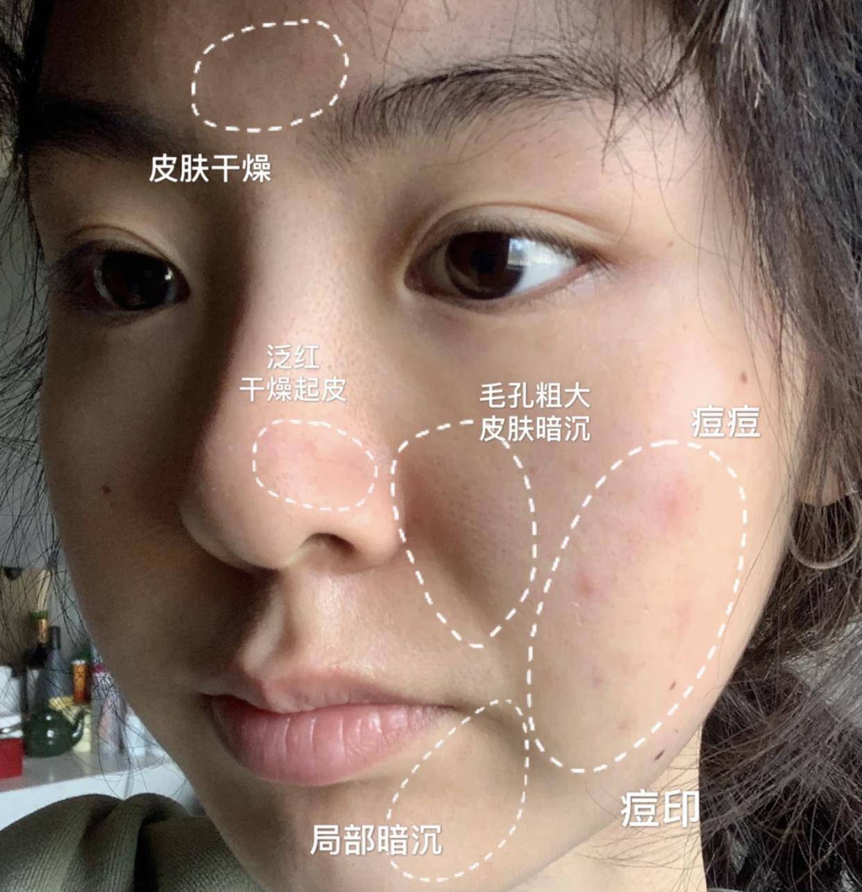 时间|面膜多久敷一次才好？难怪护肤品不吸收，皮肤还是干燥起皮！