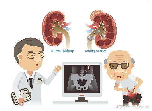 机体内|你的肾被伤得多深？出现这4个求救信号，别再说没毛病了