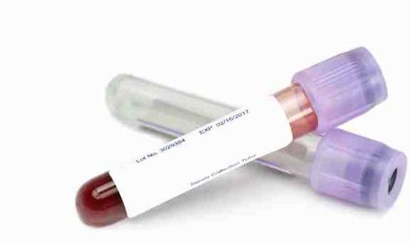 进行|正确监测血糖，预防糖尿病并发症！多久测一次？80%的人做错了