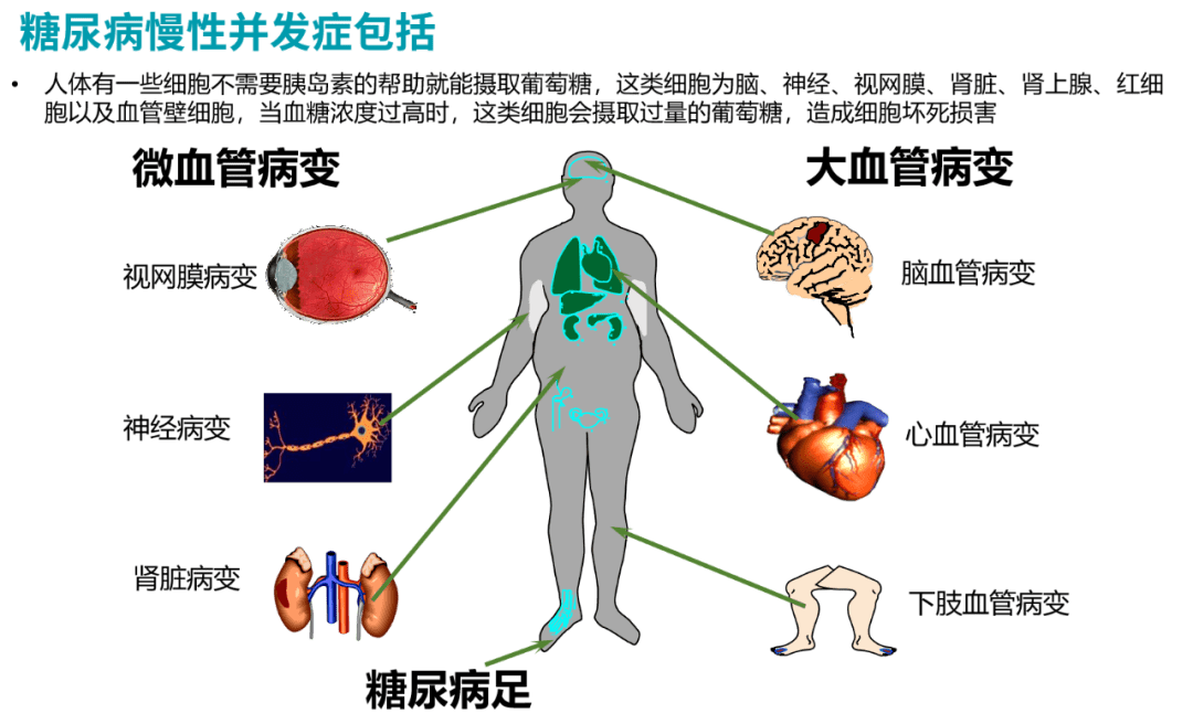 生活|糖尿病可以逆转吗？