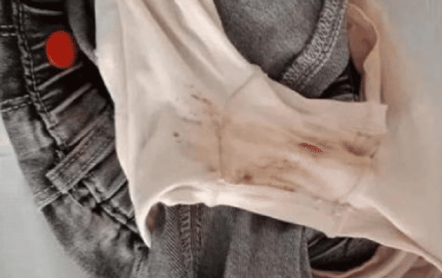 坏人|4岁女孩哭个不停，说被“面具”老爷爷欺负，裤子上还有血迹。