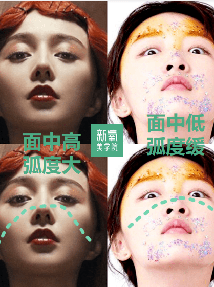 眉骨|给赵露思换了天使大宝贝的眉骨和眼眶骨，这张脸洋气指数飙升120%