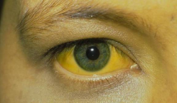 肝脏|肝癌多是“拖”出来的，4个部位出现异常，可能是肝病来袭