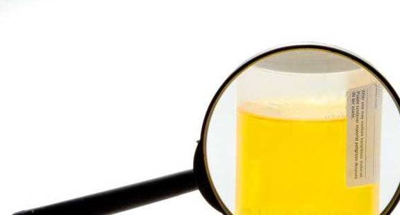 治疗|肾衰竭是尿毒症来临前的“危险信号”,这5个早期症状你必须知道