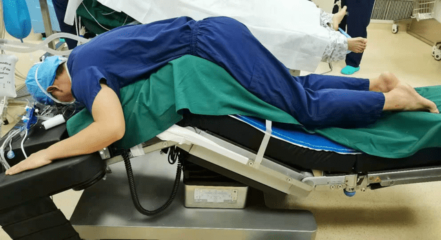 太原市中心医院骨科成功完成强直性脊柱炎脊柱后凸截骨矫形术