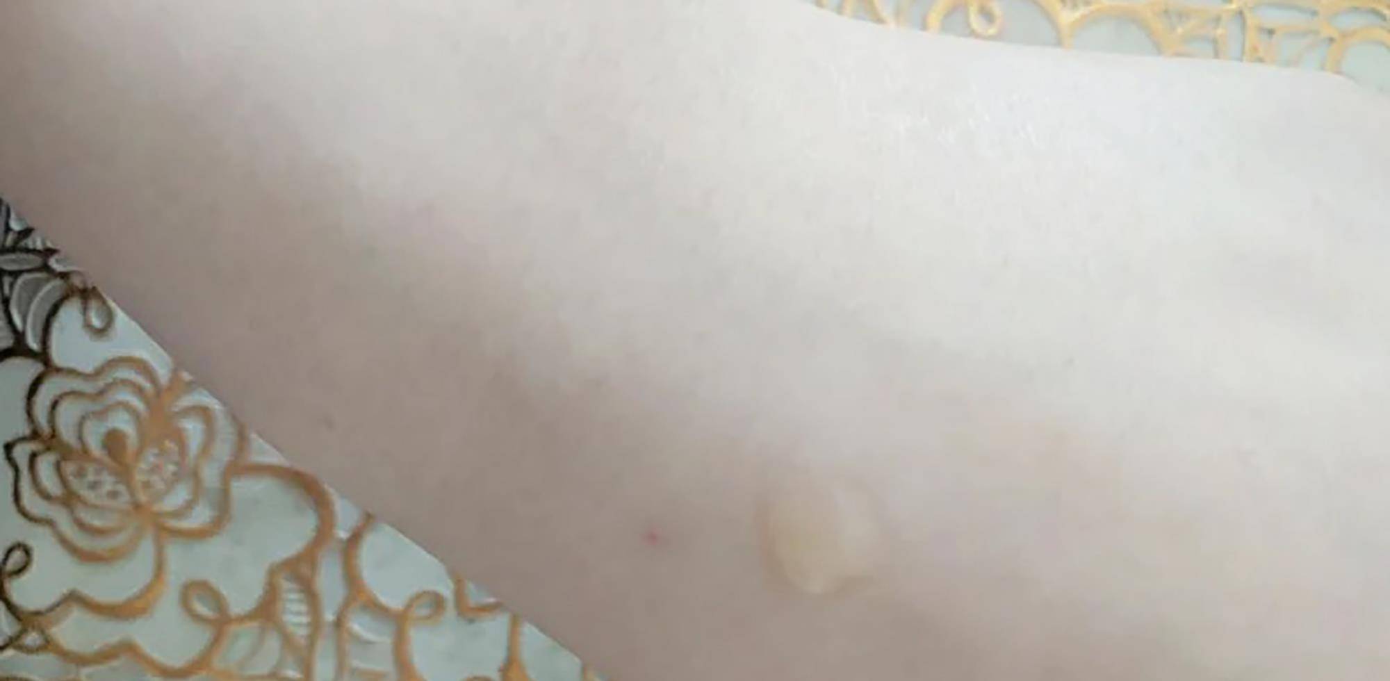 小羊|皮肤暗黄的女人，不懂给皮肤抗炎，难怪白不起来